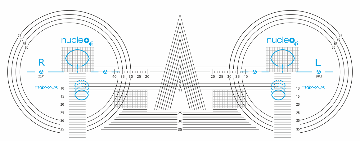 Progressive Lens Marking Chart